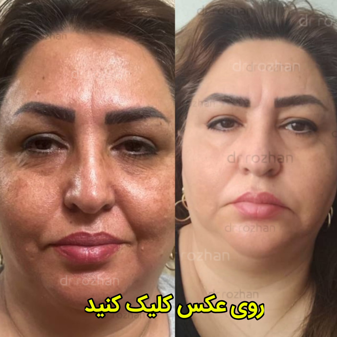 قبل و بعد از استفاده مشتری های عزیزمان